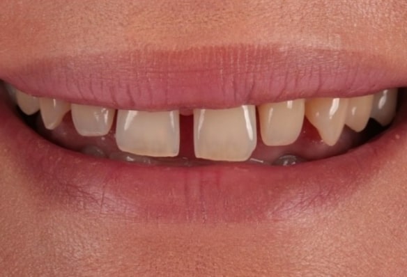 Before - Smile Success