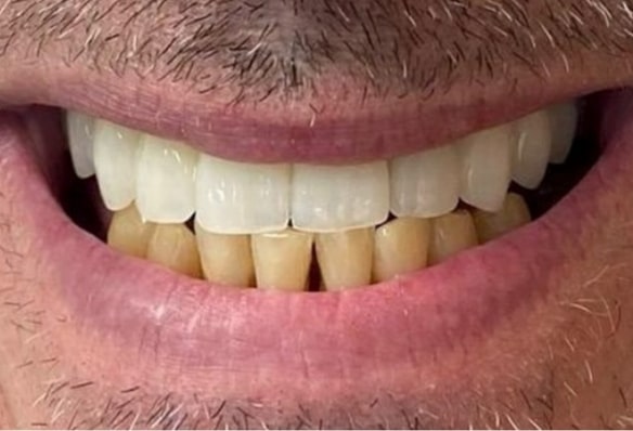 After -Smile Success