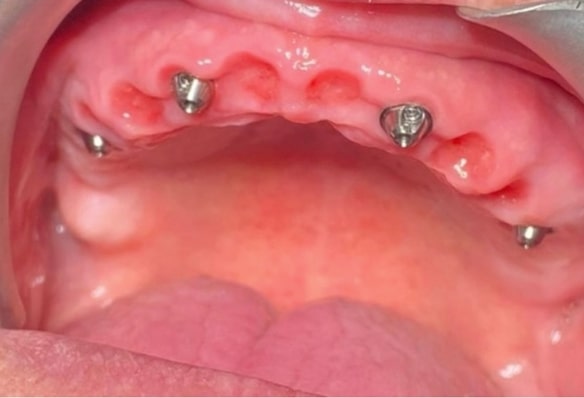 Before - Smile Success