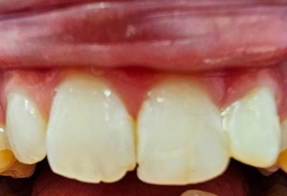 Before - Smile Success