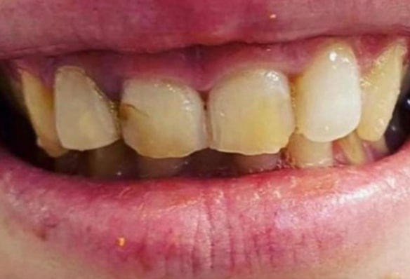 Before - Smile Success