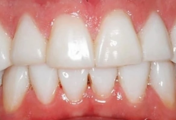 After -Smile Success