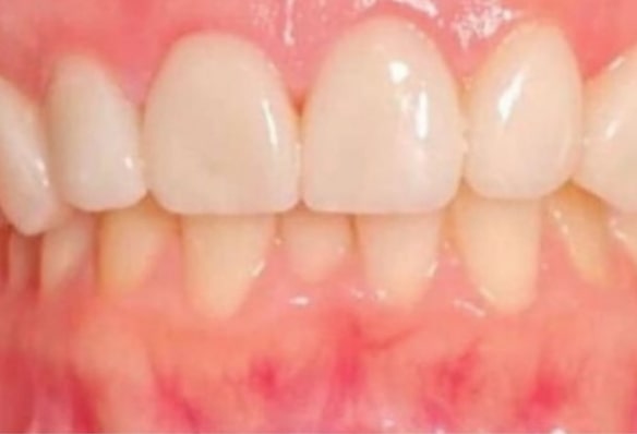 Before - Smile Success