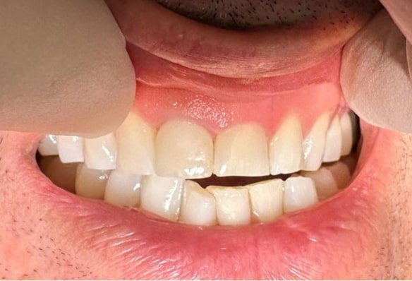 After -Smile Success