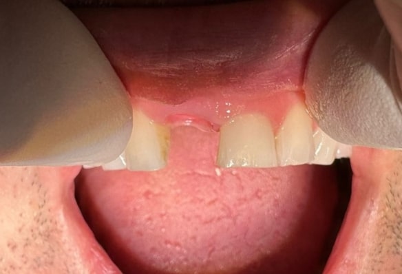 Before - Smile Success