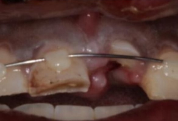 Before - Smile Success