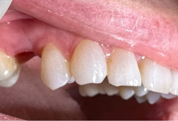 Before - Smile Success