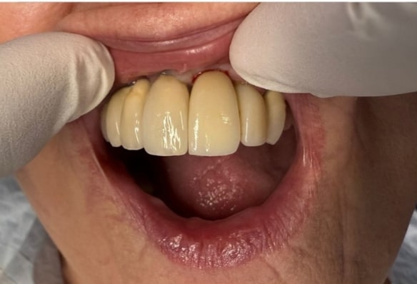 After -Smile Success