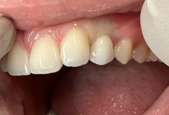 After -Smile Success