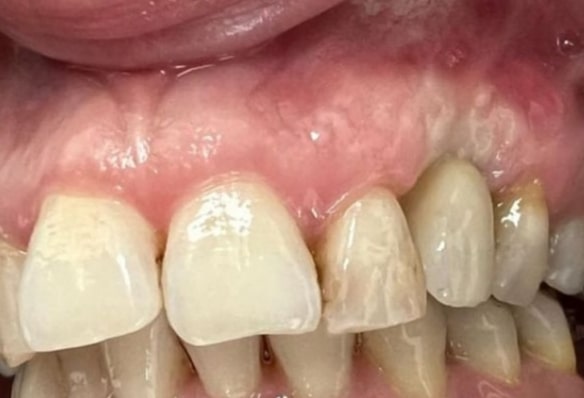 After -Smile Success