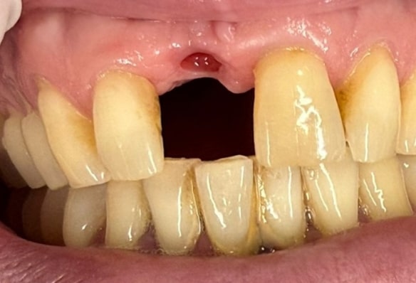 Before - Smile Success