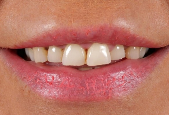 Before - Smile Success