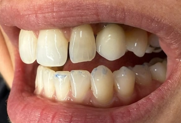 After -Smile Success