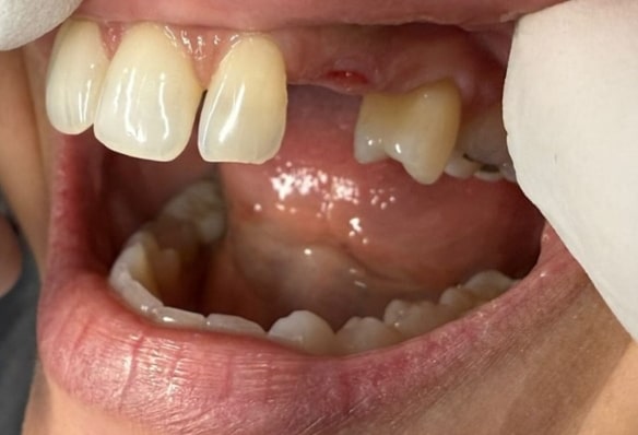 Before - Smile Success