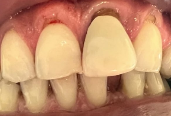 Before - Smile Success