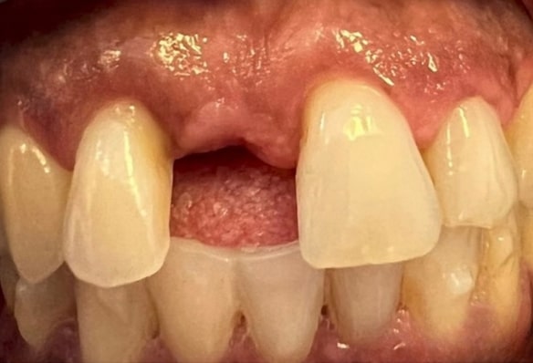 Before - Smile Success