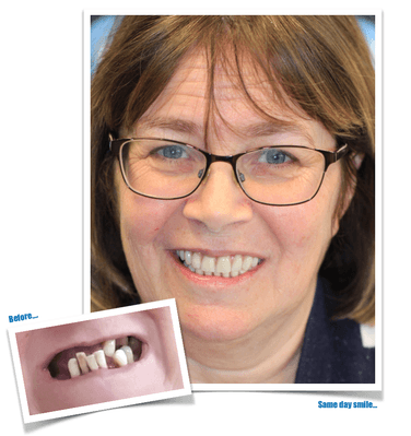 Predent Consultation Image