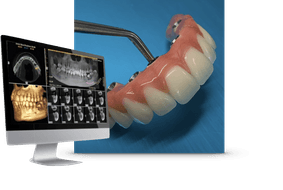 Predent Patient Journey