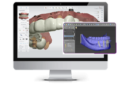 Predent Patient Journey