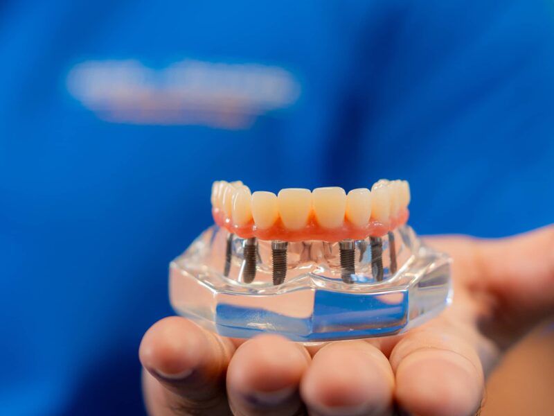 Practice Gallery Image - Smile Success