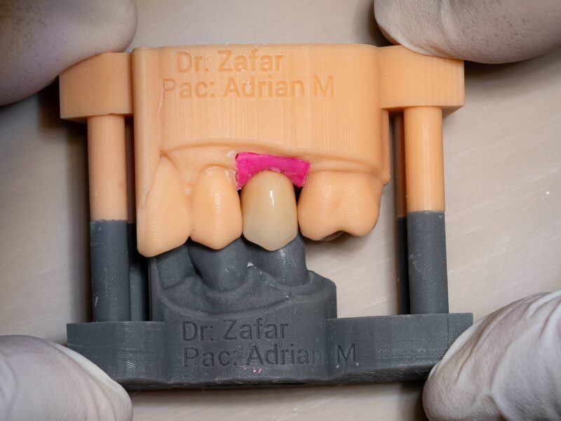 Practice Gallery Image - Smile Success