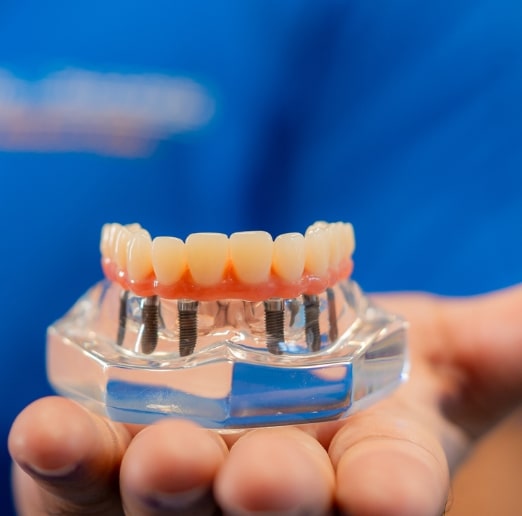 Predent General, Cosmetic & Implant Dentistry