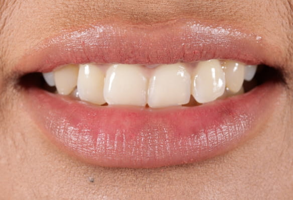 Before - Smile Success
