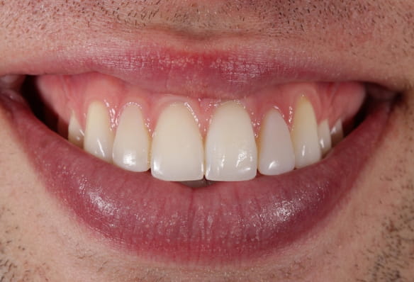 After -Smile Success
