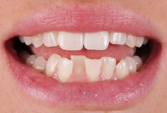 Before - Smile Success