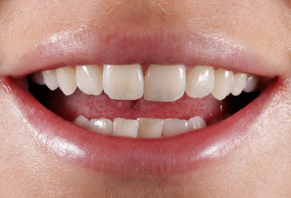 Before - Smile Success