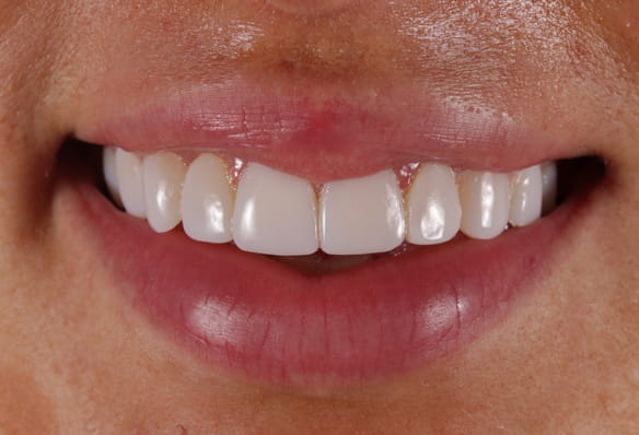 After -Smile Success