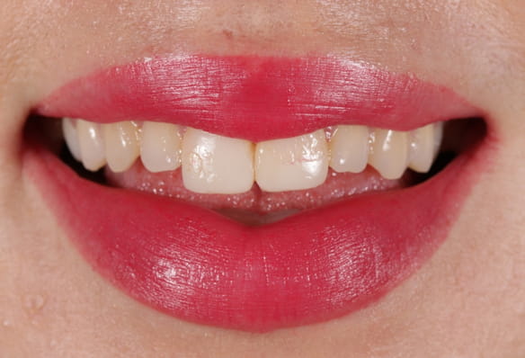 Before - Smile Success