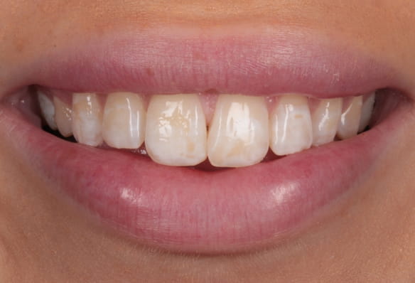 Before - Smile Success