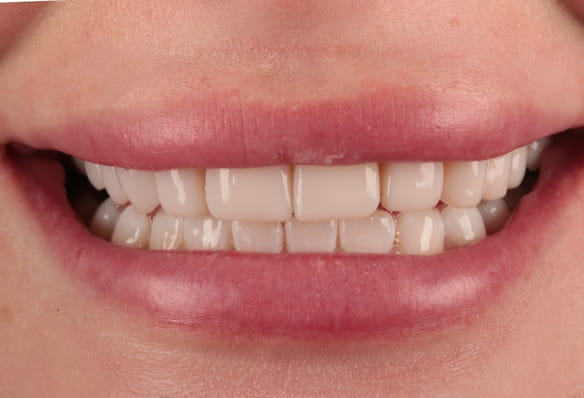 After -Smile Success