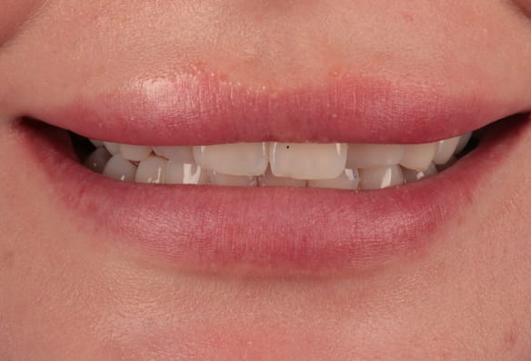 Before - Smile Success