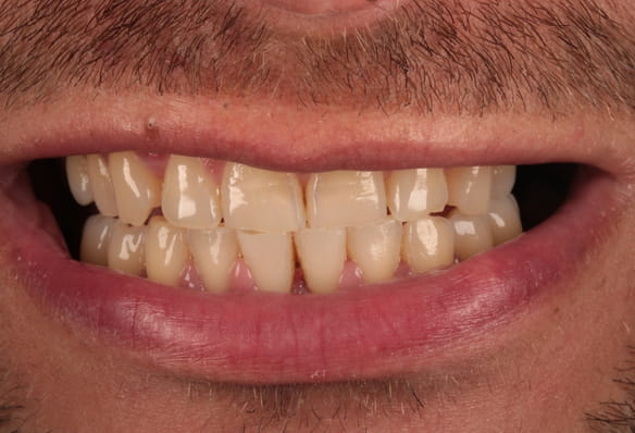 Before - Smile Success
