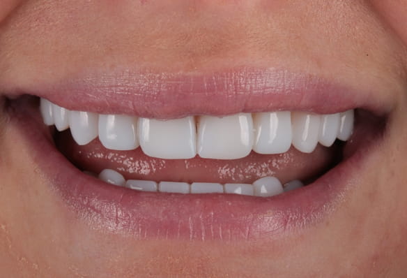 After -Smile Success