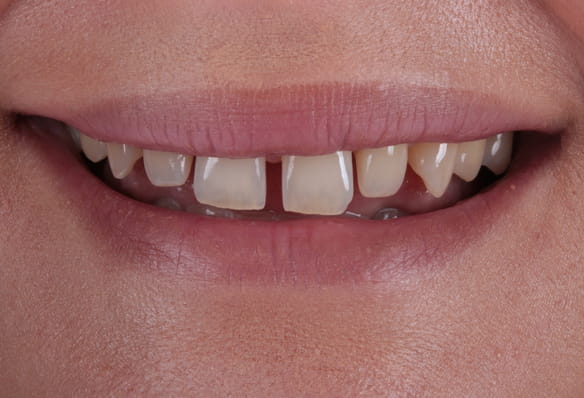 Before - Smile Success