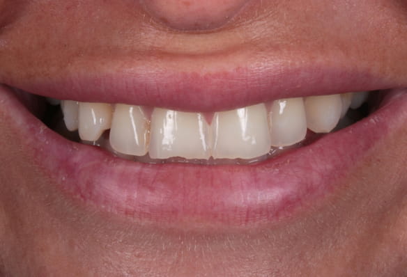 Before - Smile Success
