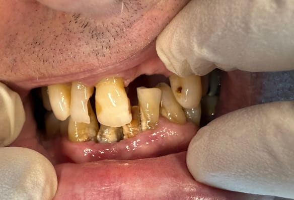 Before - Smile Success