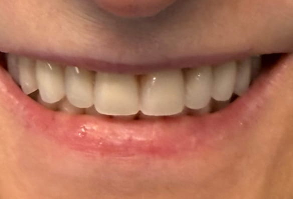 After -Smile Success