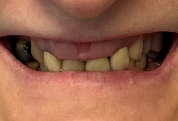 Before - Smile Success