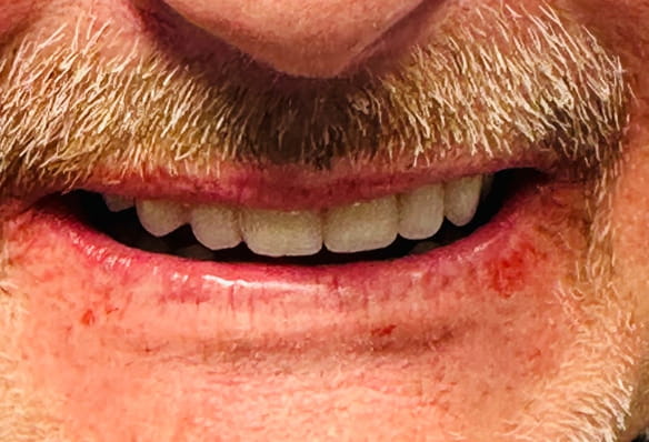 After -Smile Success