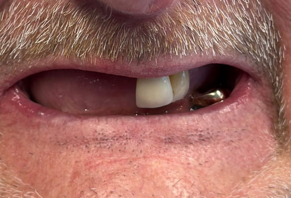 Before - Smile Success