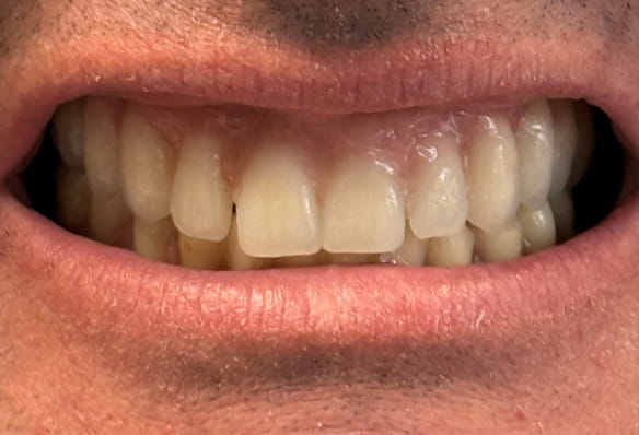 After -Smile Success