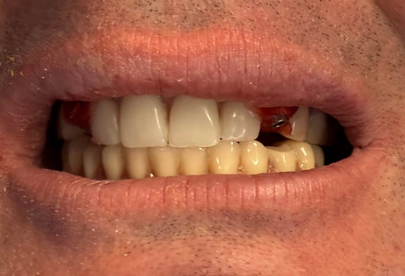 Before - Smile Success