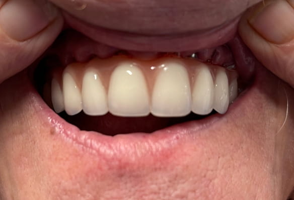 After -Smile Success