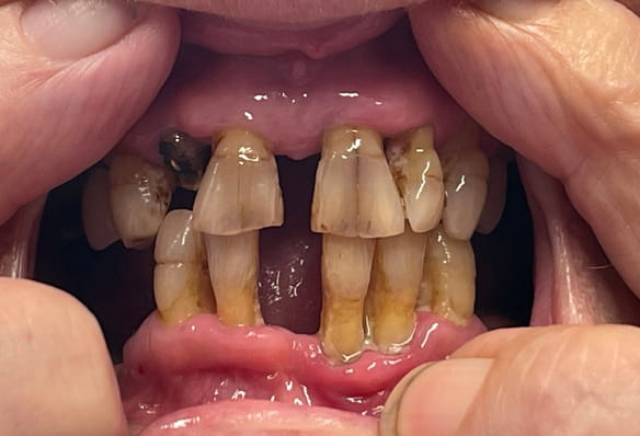 Before - Smile Success