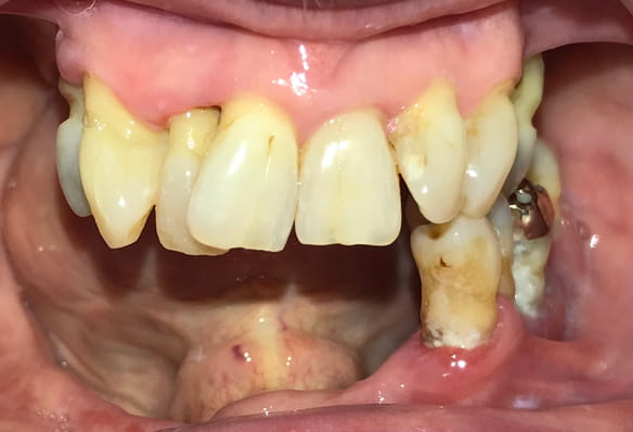 Before - Smile Success