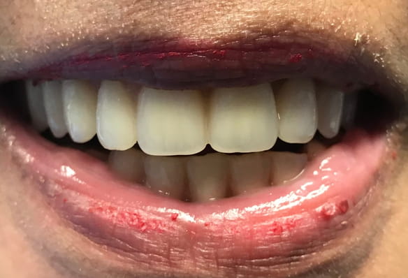 After -Smile Success